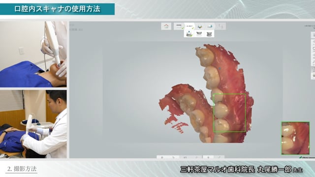 【Technical Notes】口腔内スキャナの使用方法