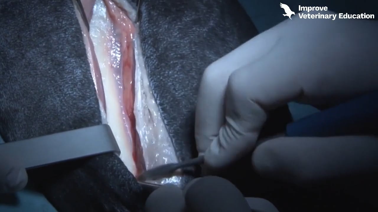 Approach to Accessing the Femur