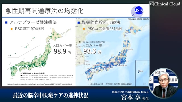 最近の脳卒中医療ケアの進捗状況