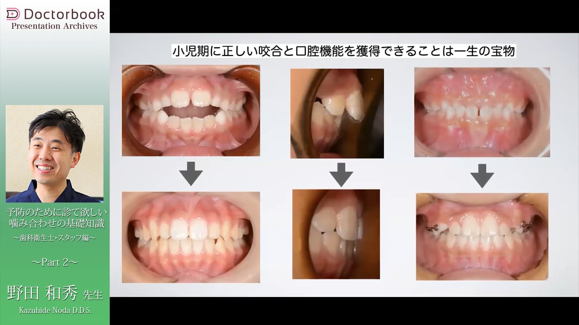 補綴治療に必要な咬合の基礎知識