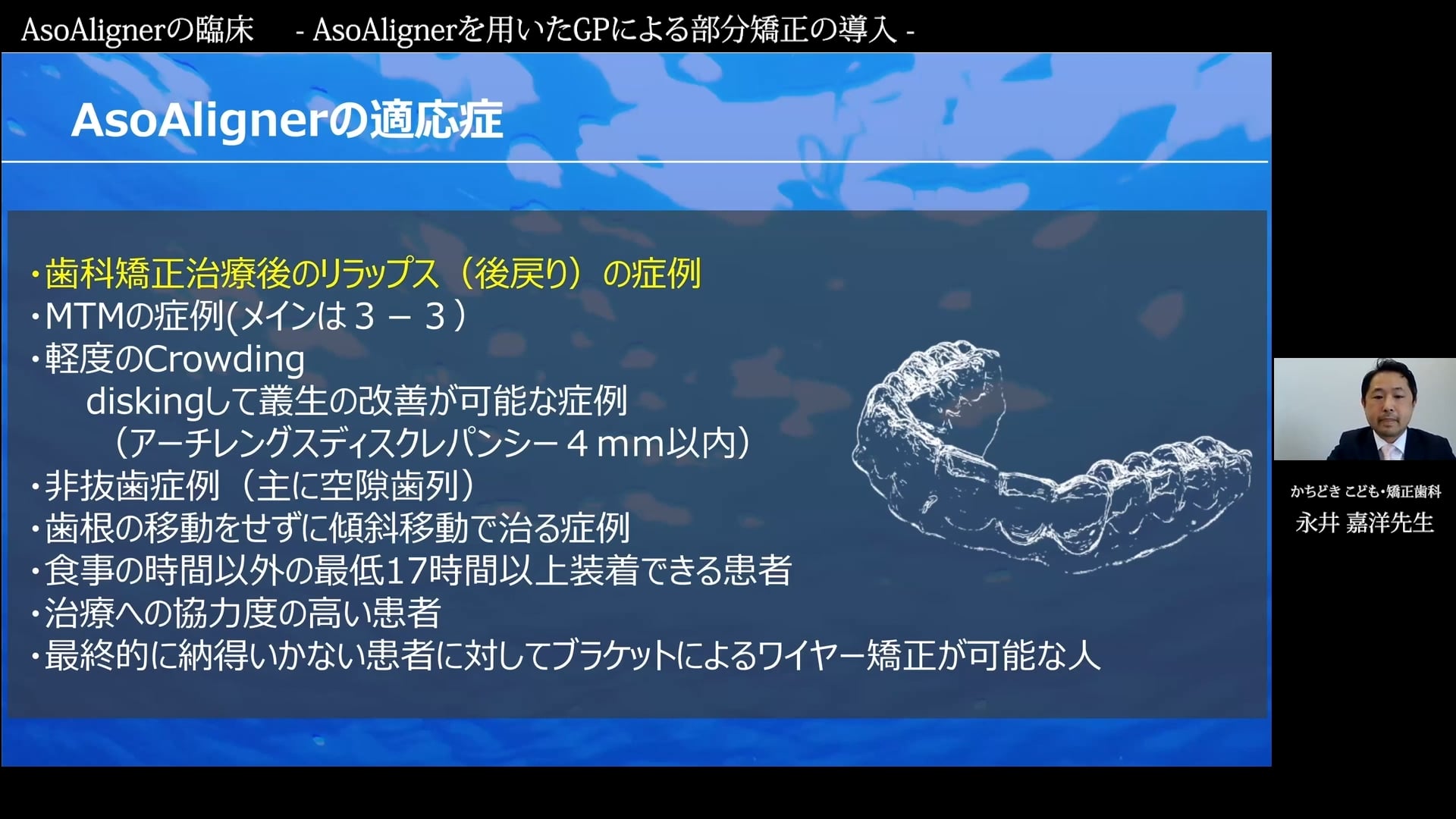 臨床知見録_アライナー矯正_ASOアライナーの適応症と非適応症