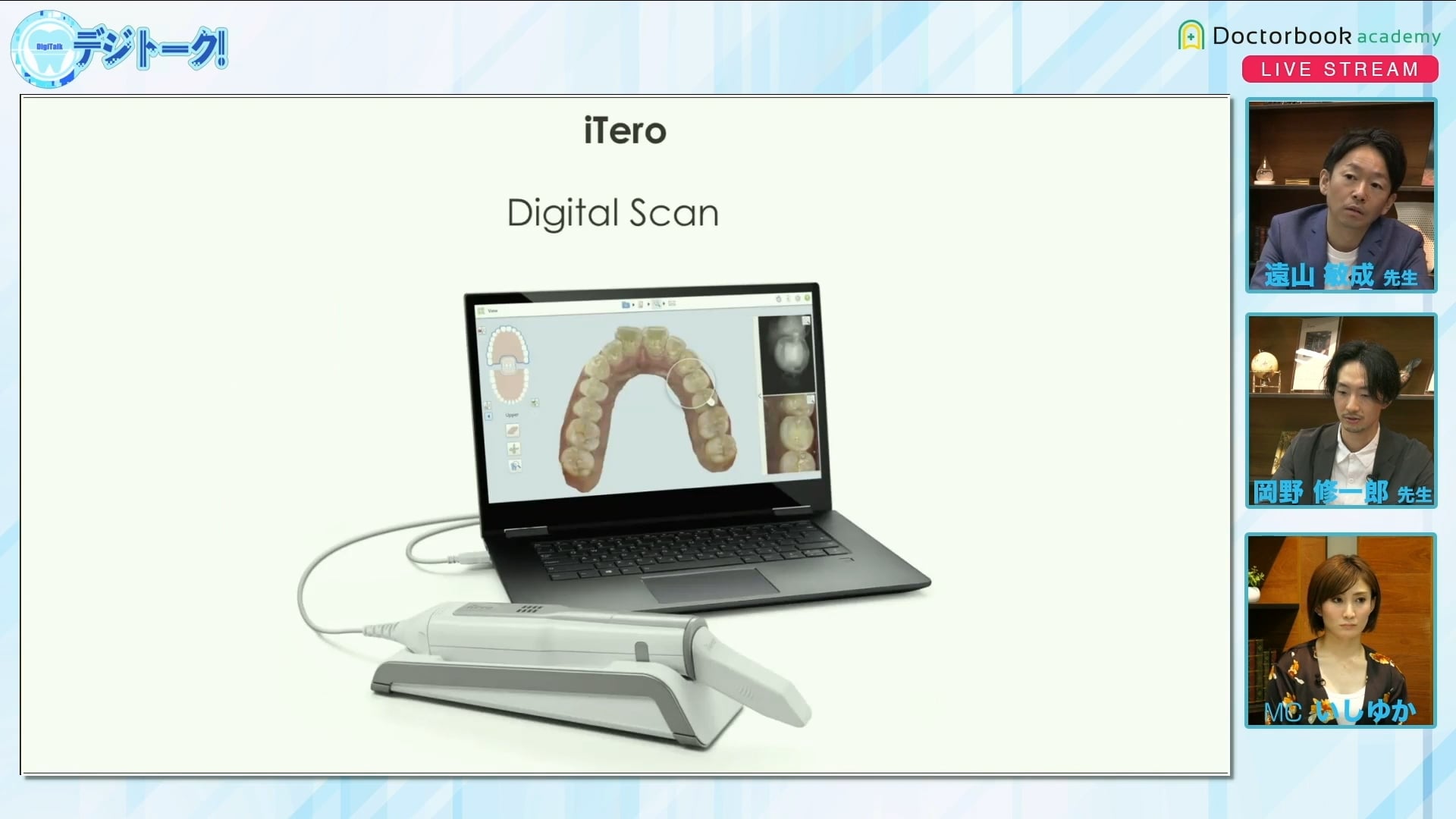 臨床知見録_アライナー矯正_iTeroの導入とインビザライン