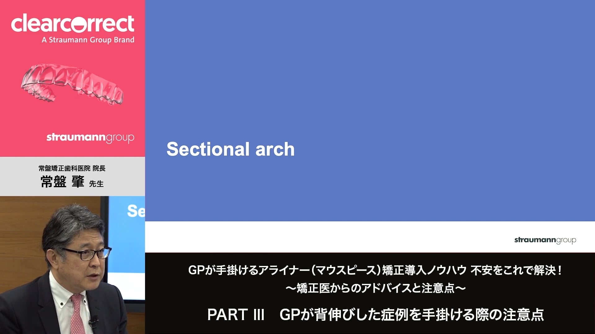 臨床知見録_アライナー矯正_セクショナルアーチ