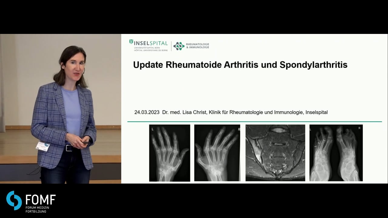 Update Rheumatoide Arthritis und Spondylarthritis