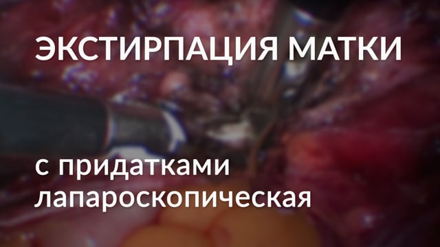 Как вырезают матку и трубы