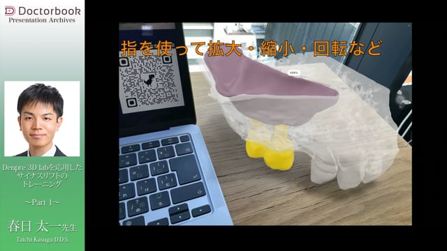 Denpre 3D Lab が可能にした高性能術前シミュレーション│Part1