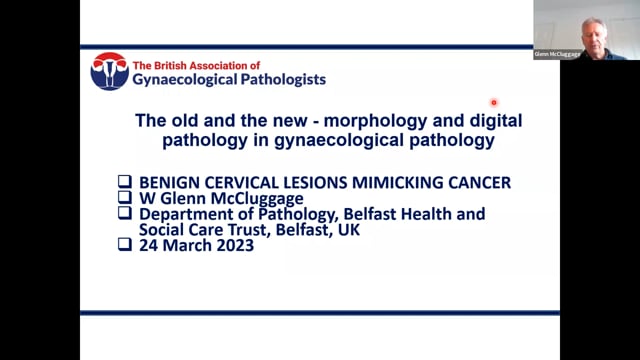 Cervical abnormalities mimicking cancer, Prof Glenn McCluggage