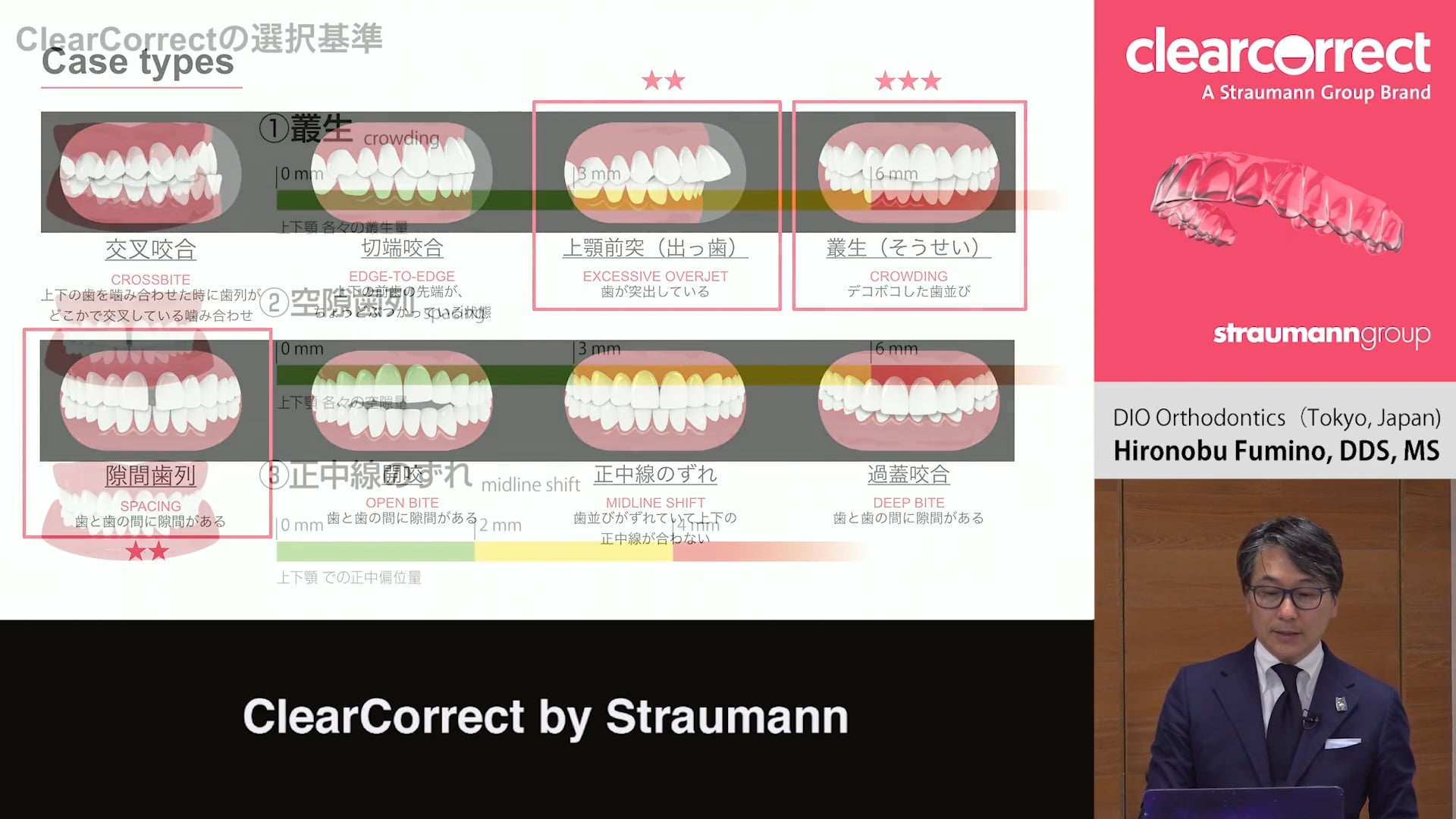 臨床知見録_アライナー矯正_クリアコレクト適応症例