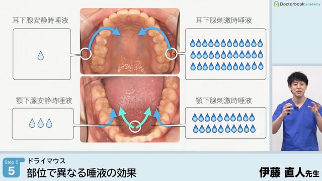 部位で異なる唾液の効果│Step5-5