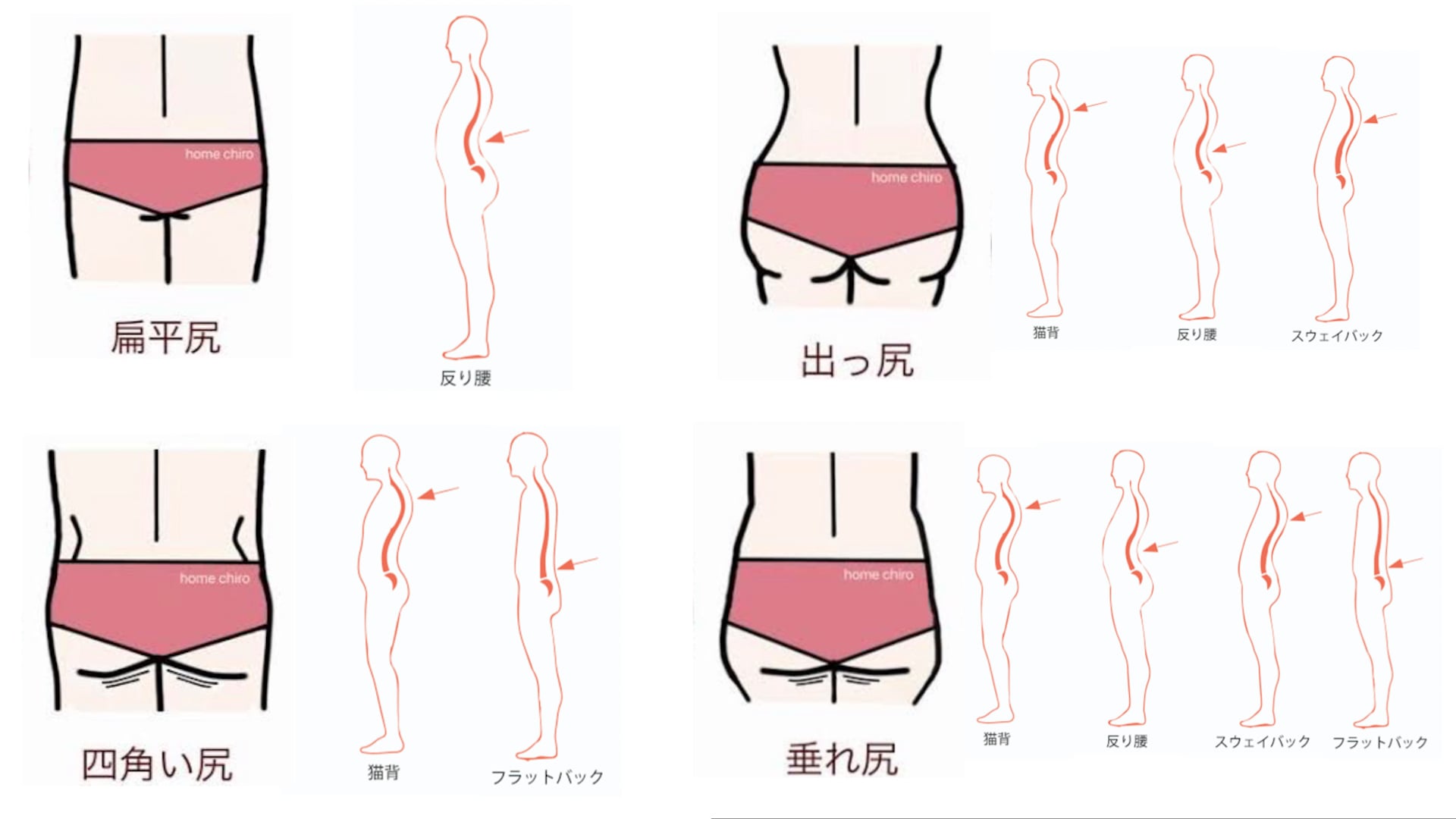 オンライン実技講習：おしりの形で体のタイプを見分ける〜視診術〜