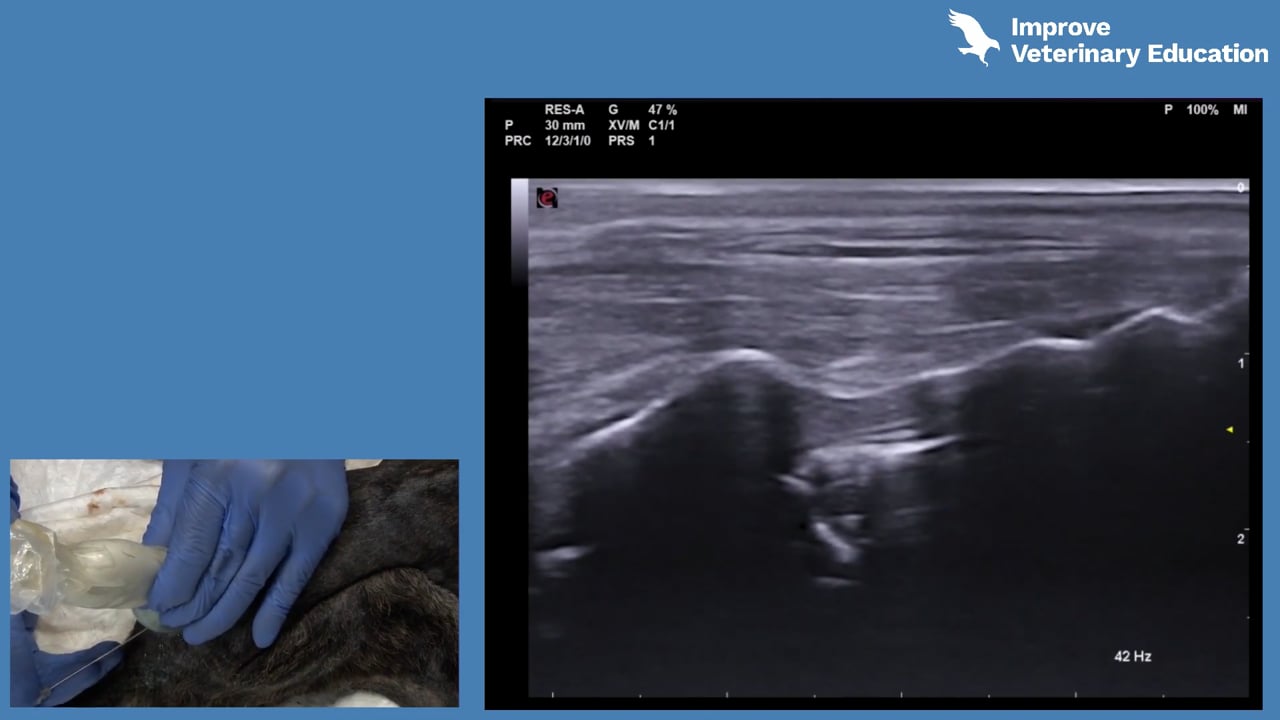 Ultrasound-guided lumbosacral epidural
