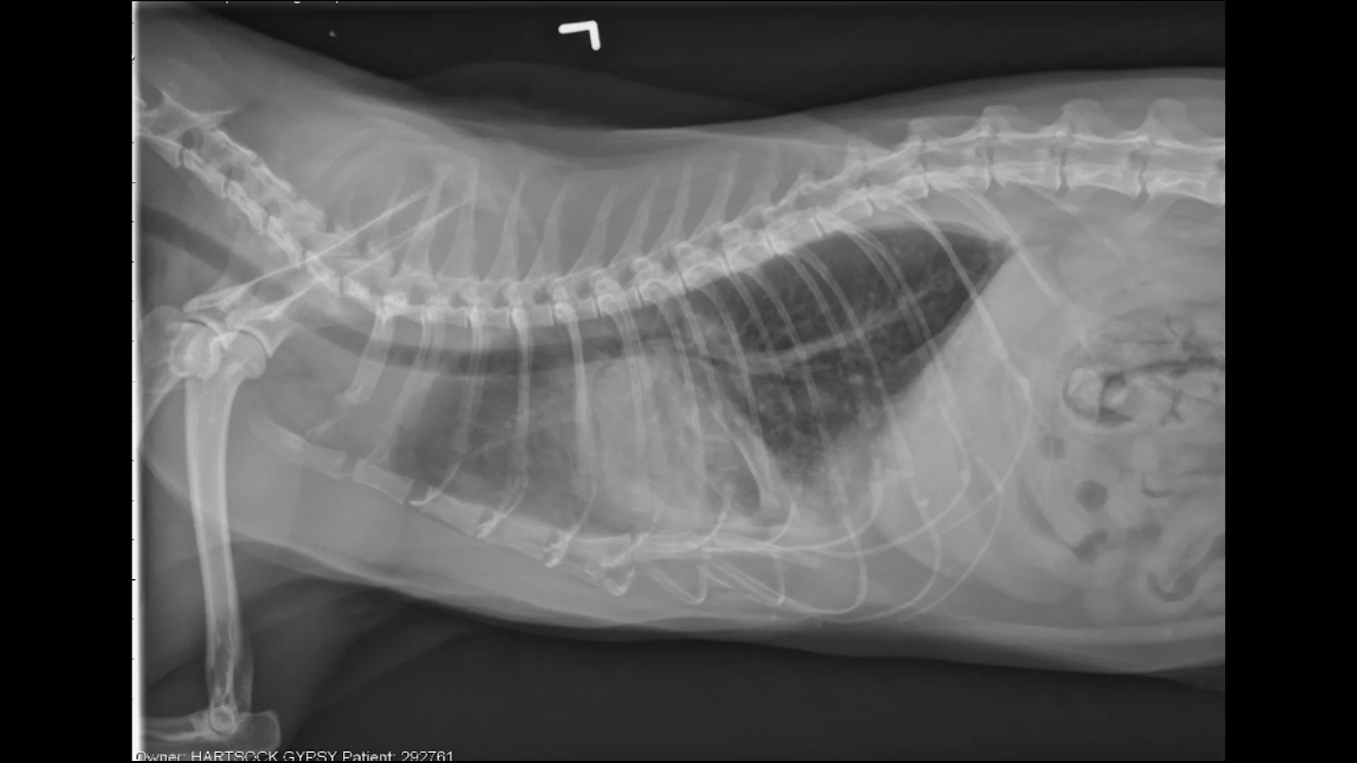 Adm_Radiology KCC Videos_Johnson_Case 3 Images_230411 on Vimeo