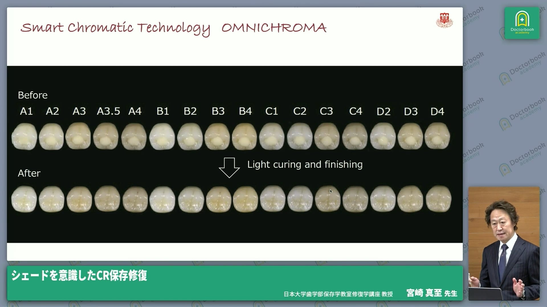 シェードを意識したCR保存修復│CRコングレス～CR・接着の真価を再考する～