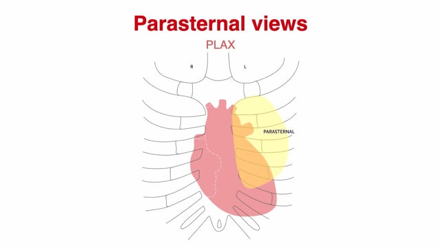 What are the benefits and limitations of the PLAX and PSAX views?