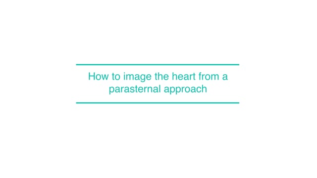 How to image the heart from a parasternal approach