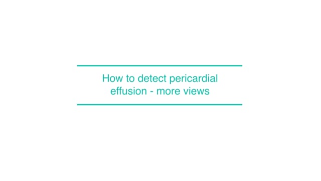 How to detect pericardial effusion - more views