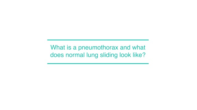 What is a pneumothorax and what does normal lung sliding look like? 