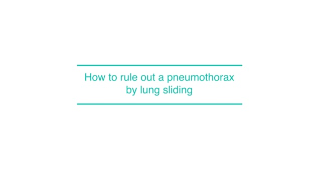 How to rule out a pneumothorax by lung sliding