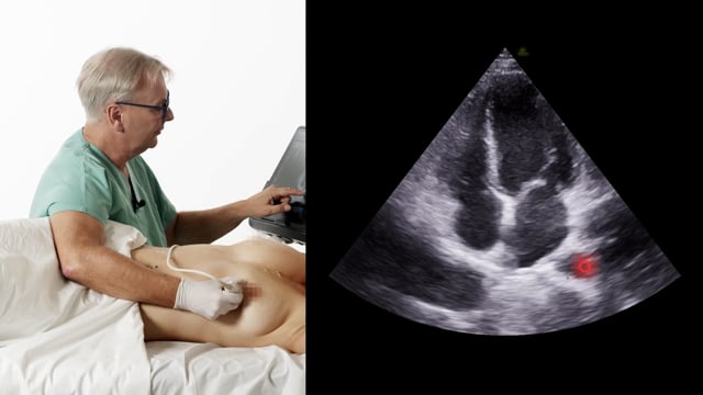 How to scan the descending aorta from an apical approach