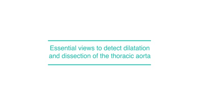 Essential views to detect dilatation and dissection of the thoracic aorta