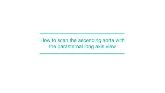 How to scan the ascending aorta with the parasternal long axis view