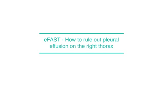 eFAST - How to rule out pleural effusion on the right thorax
