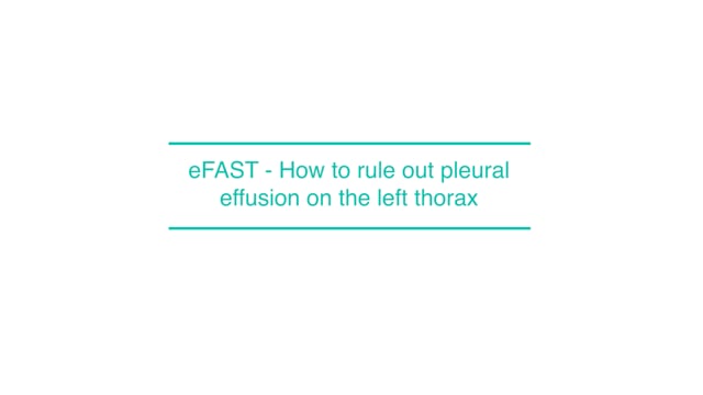 eFAST - How to rule out pleural effusion on the left thorax