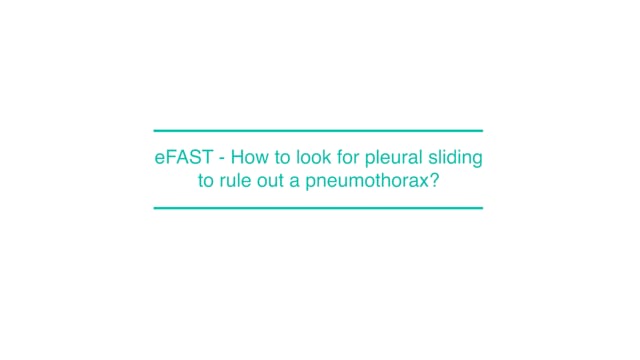 eFAST - How to look for pleural sliding to rule out a pneumothorax?