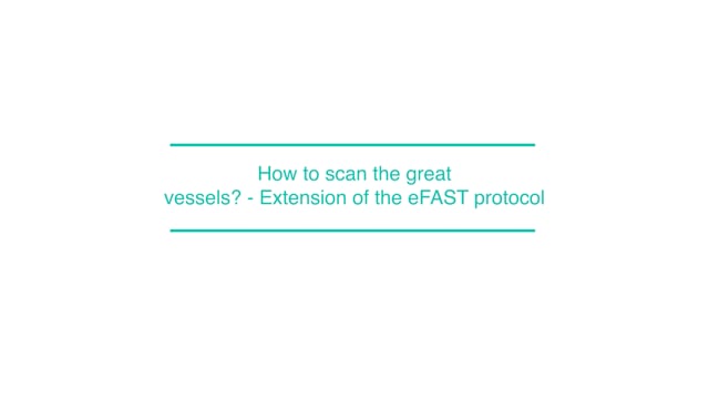 How to scan the great vessels ? - Extension of the eFAST protocol