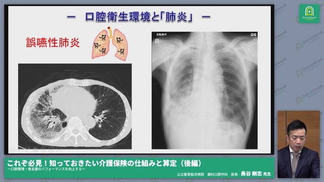 認知症「施設入所者」の口腔の特徴と歯科としてサポートできること