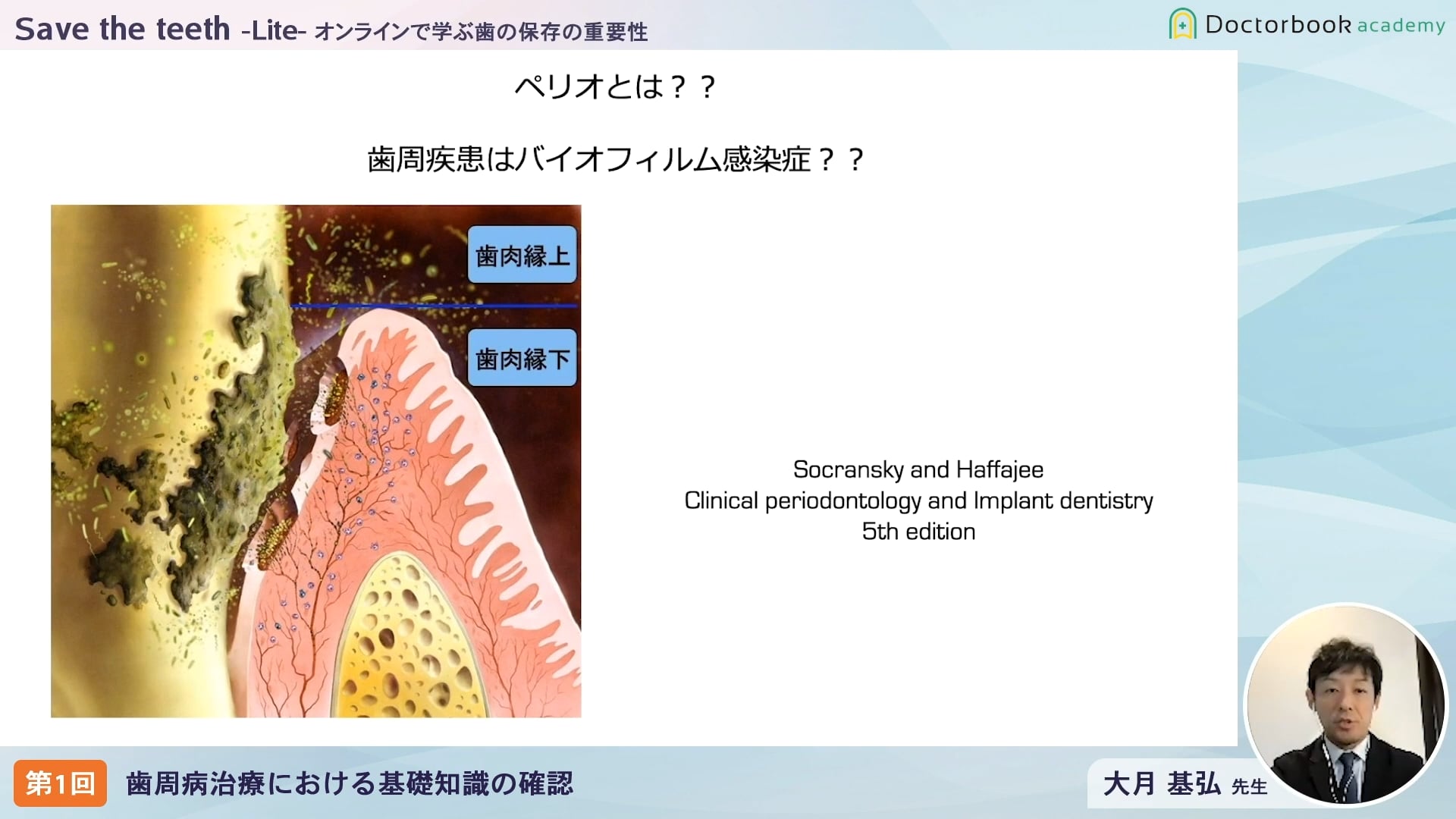 臨床知見録_歯周病の検査・初期治療_ペリオとは？