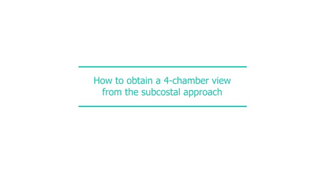 How to obtain a 4-chamber view from the subcostal approach