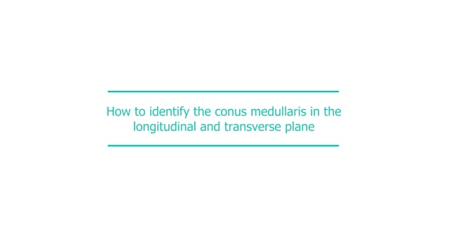 How to identify the conus medullaris in the longitudinal and transverse plane