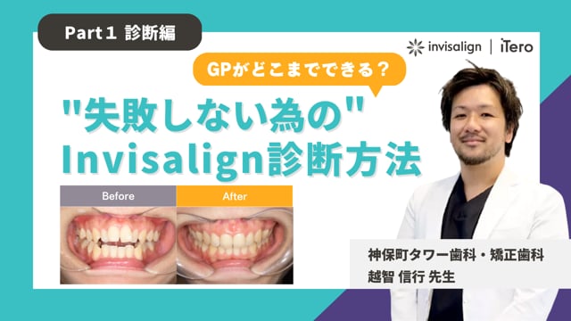 【Part1：診断編】GPがインビザラインの導入を成功させるためのノウハウ