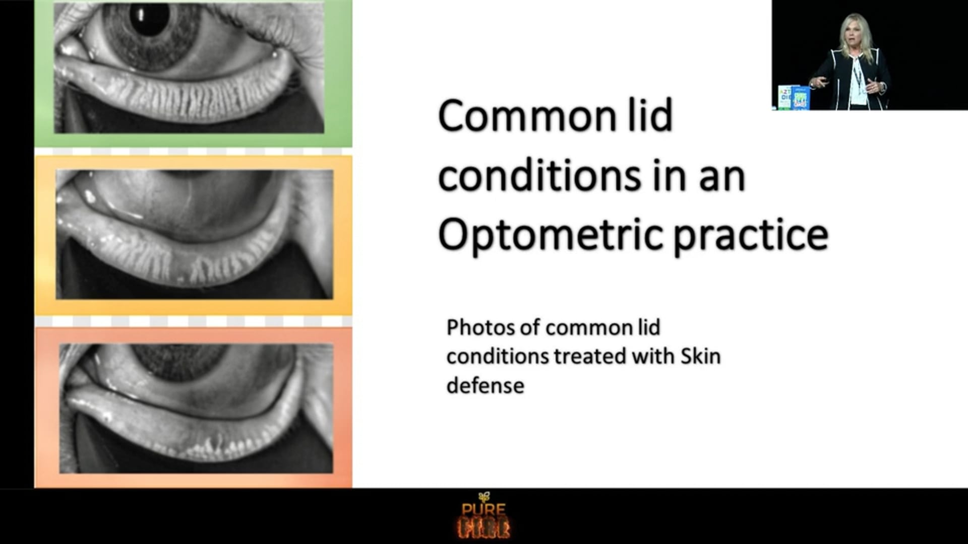 PURE for your EYE HEALTH