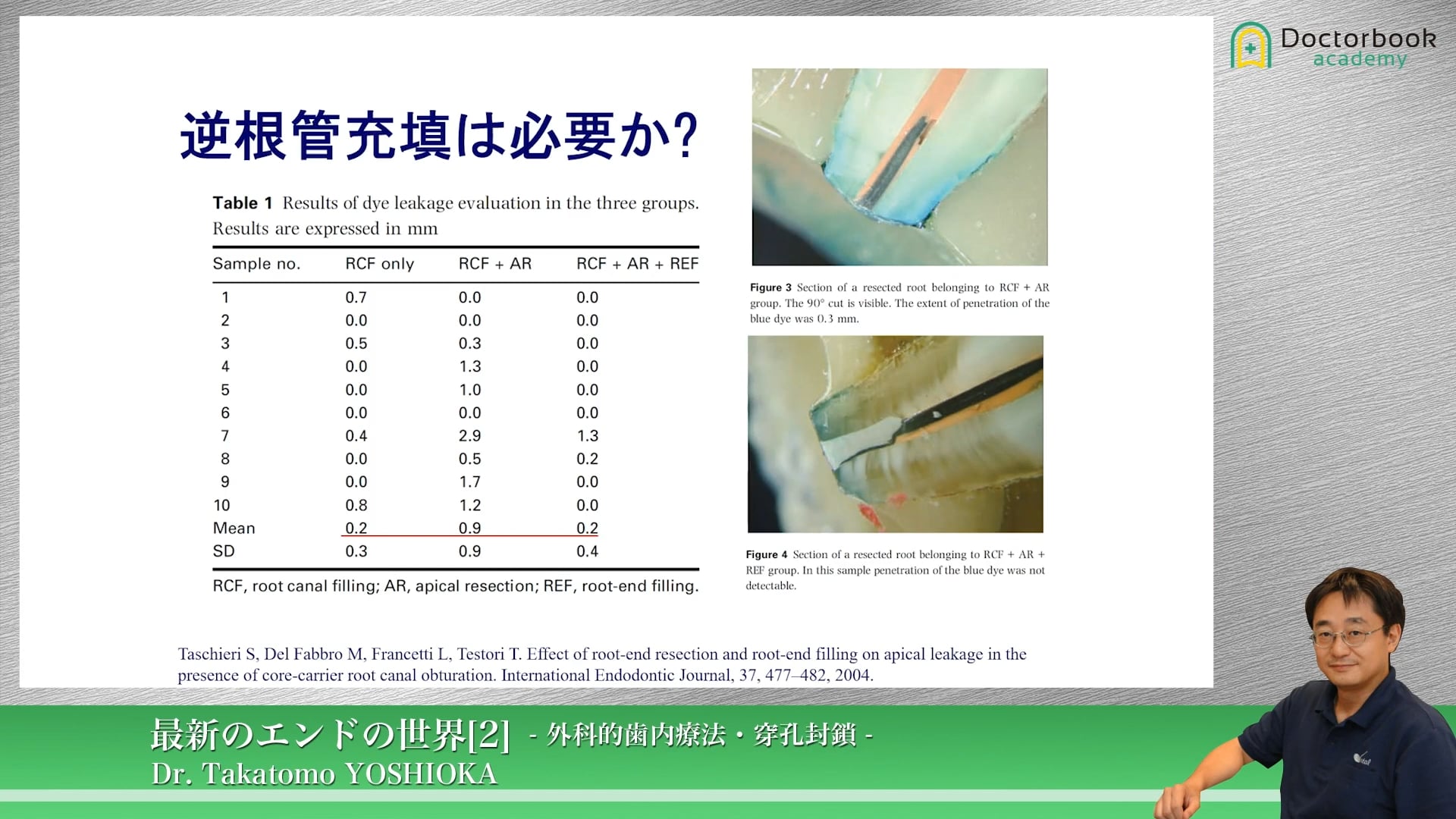 臨床知見録_歯根端切除_逆根管充填の必要性