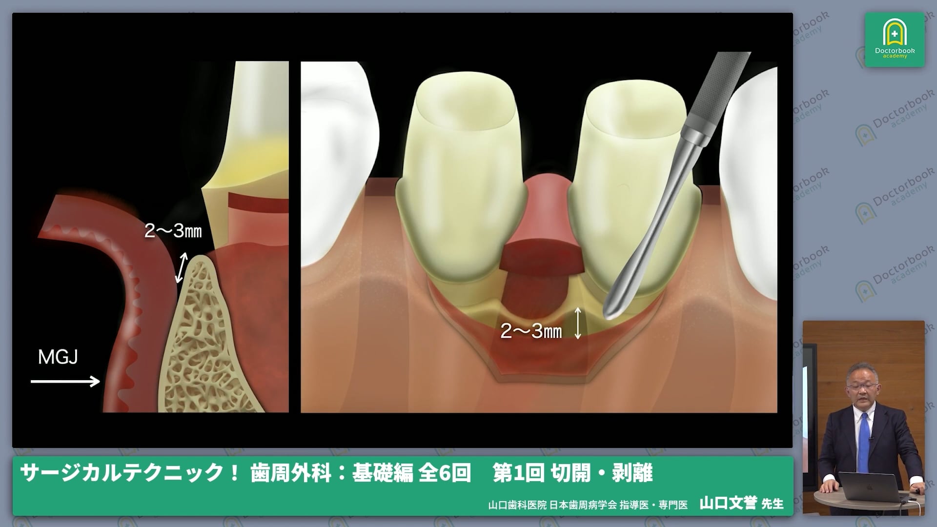 臨床知見録_切開・剥離・縫合_日常臨床の疑問点