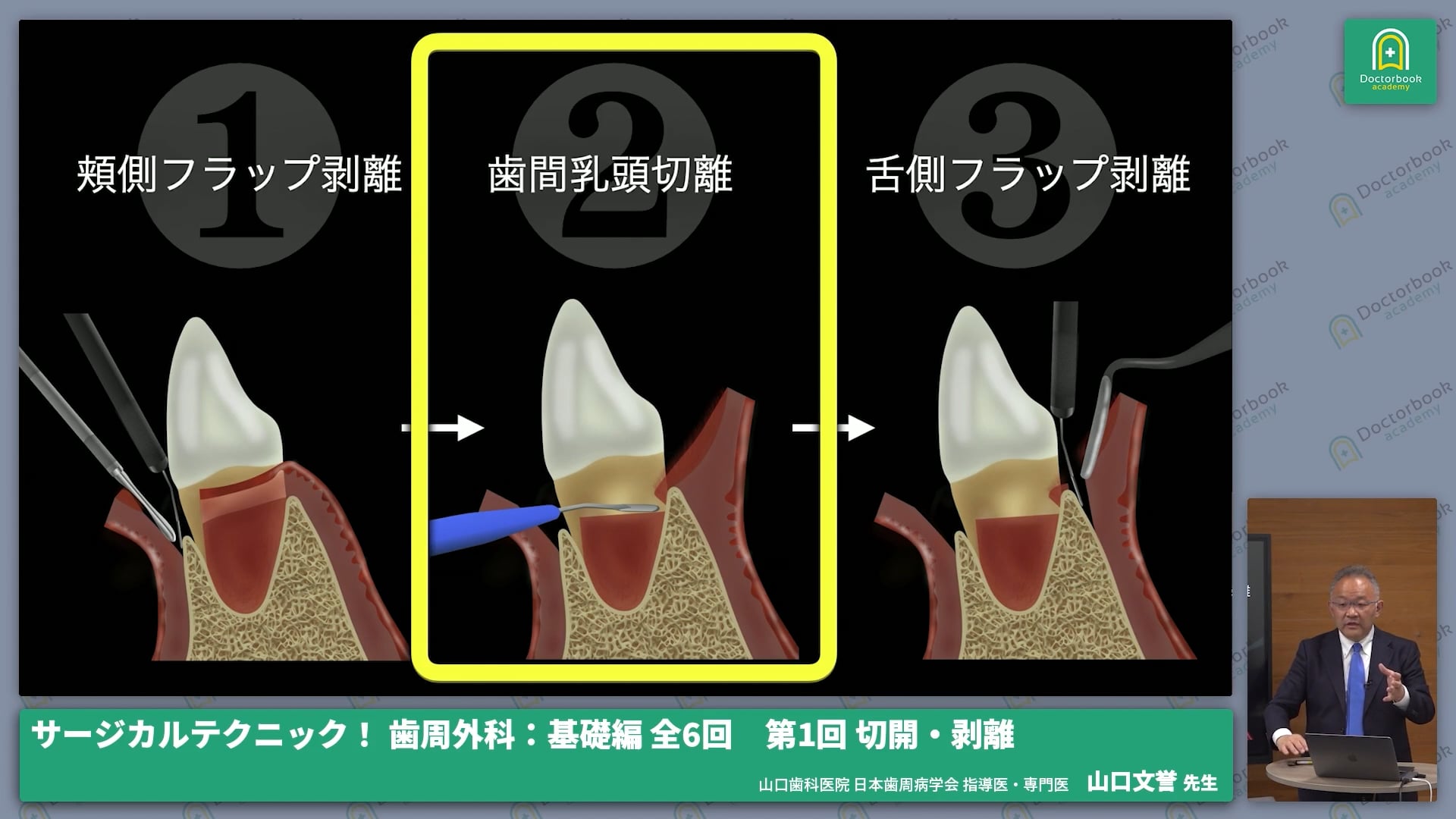 臨床知見録_切開・剥離・縫合_ミニクレセントナイフ・マーチンマイクロ起子・剥離子