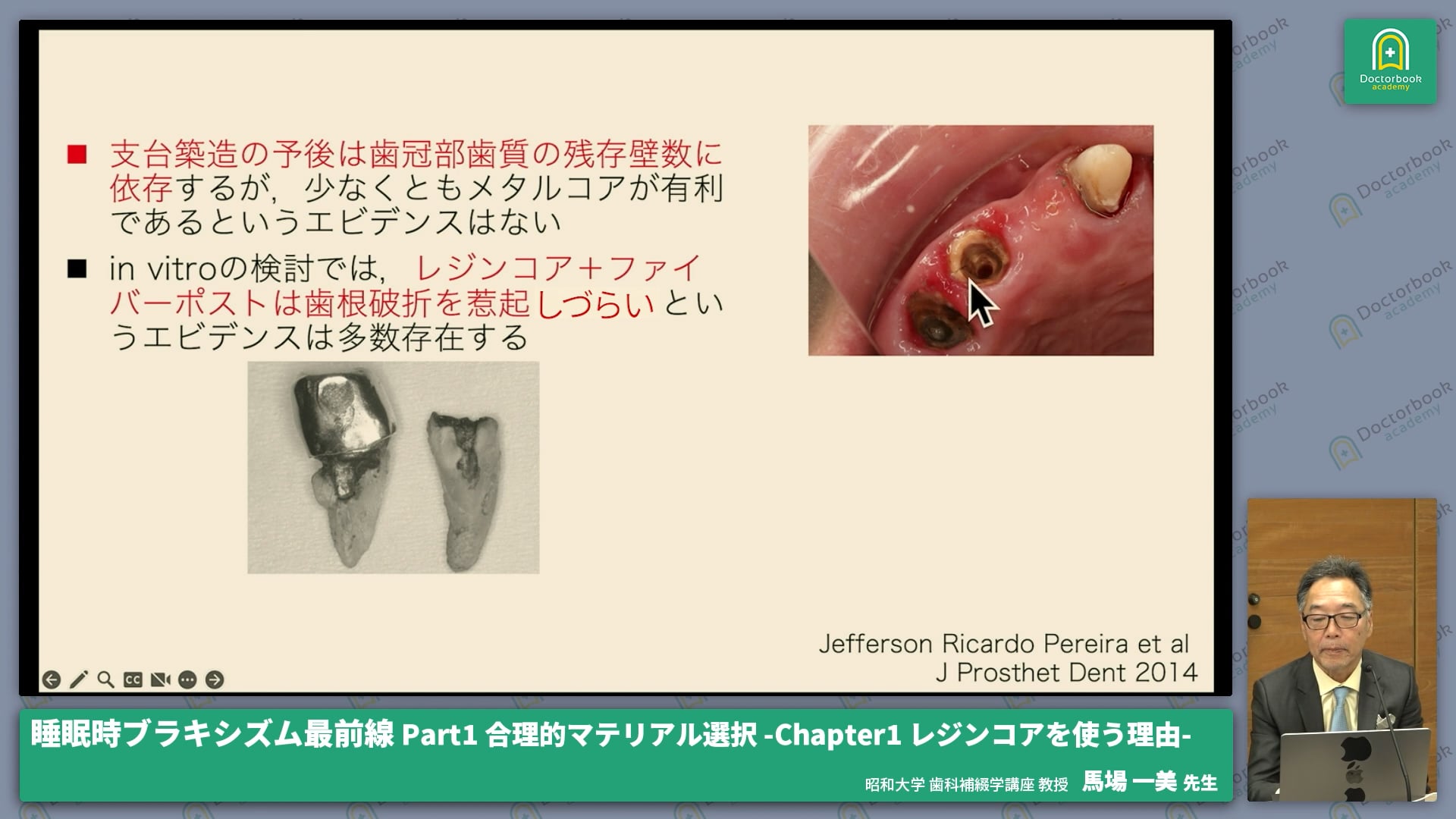 Part1 合理的マテリアル選択-Chapter1 レジンコアを使う理由-