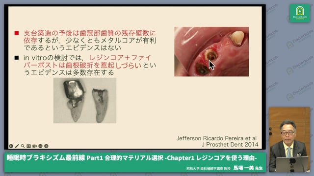 Part1 合理的マテリアル選択-Chapter1 レジンコアを使う理由-