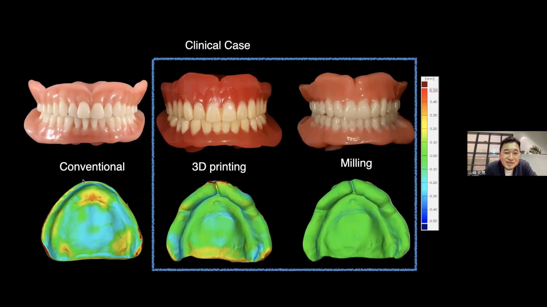 デジタルデンチャーの製作過程と精度・強度（山崎史晃先生）│Denture Cafe 第40回 #1