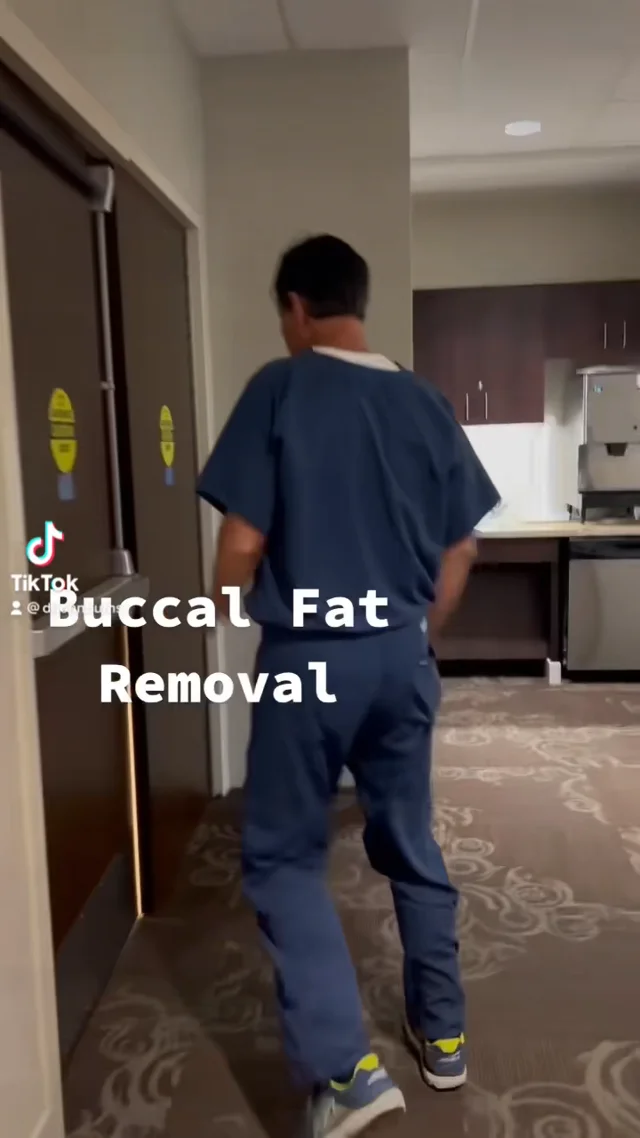 Dallas Buccal Fat Pad Removal by Dr. John Burns – Dr John Burns