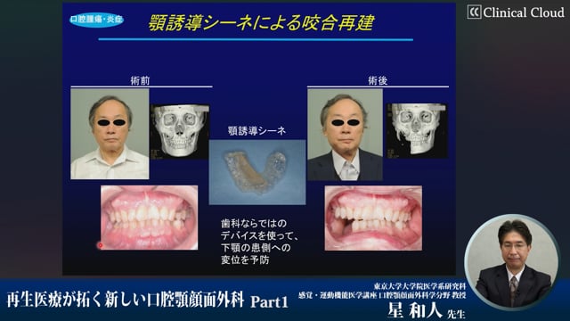 再生医療が拓く新しい口腔顎顔面外科 #1