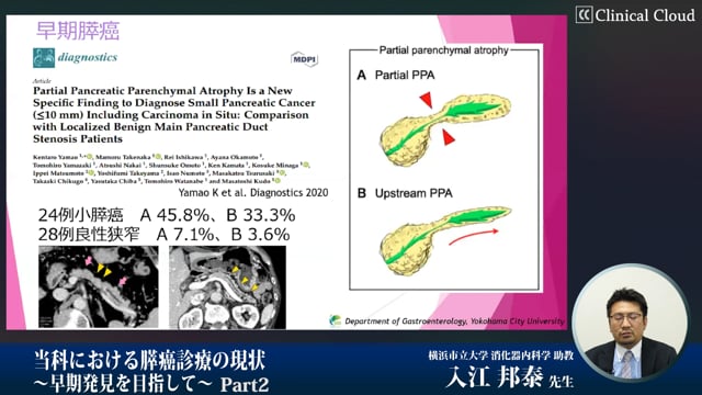 当科における膵癌診療の現状～早期発見を目指して～　Part2