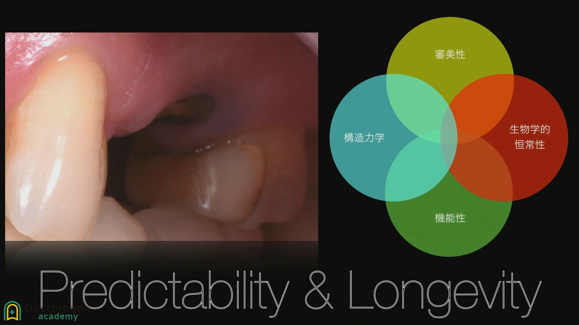 臨床知見録_クラウンレングスニング_Predictability&Longevity