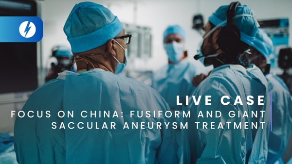 Focus on China: Fusiform and giant saccular aneurysm treatment