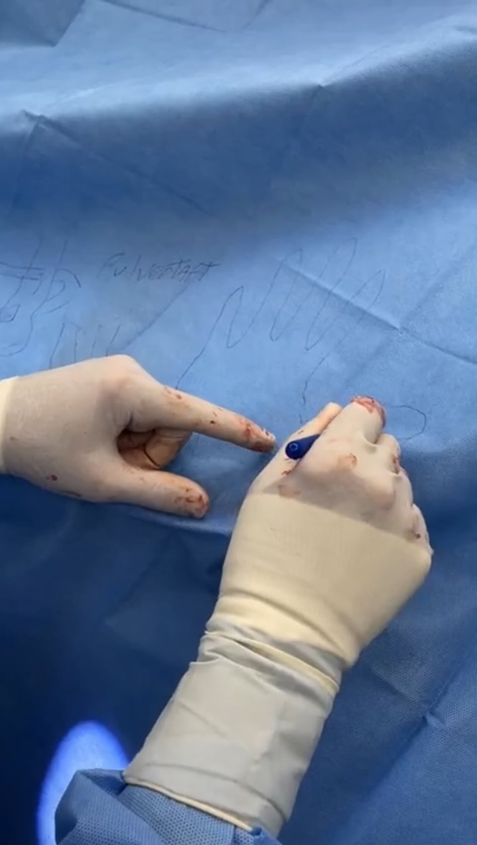 Live surgery tuesday tendon transfer