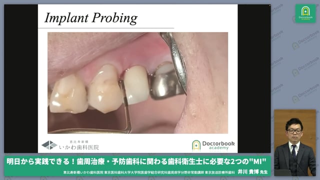 歯周基本治療：SCについて #5