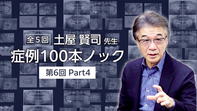 土屋賢司先生 症例100本ノック 第6回 PART4