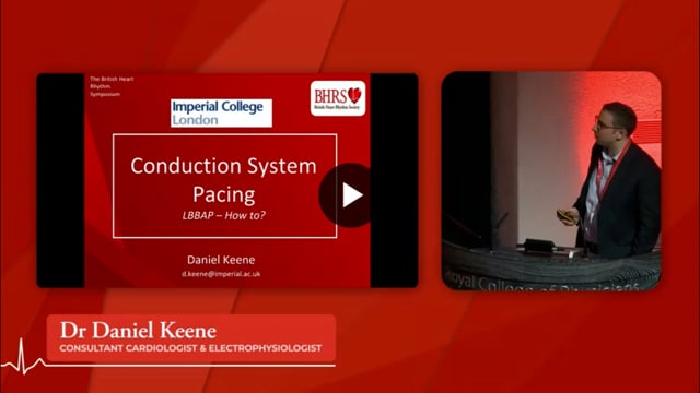 PREVIEW Left Bundle Branch Area Pacing, easier than you think - Daniel Keene